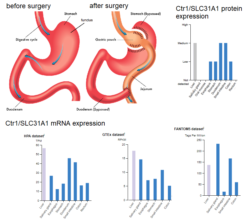 CuEyeHealth_astricbypass