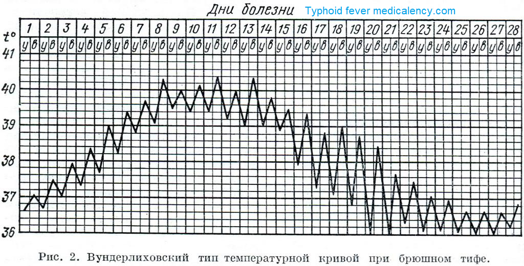 Fever_typhoid
